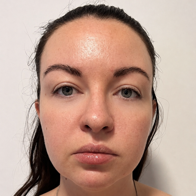 Younger skin