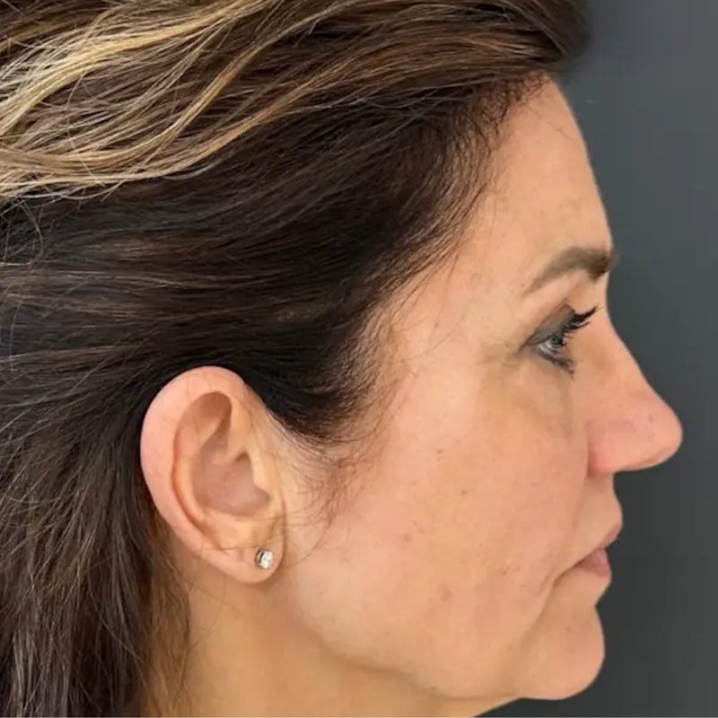 Younger skin