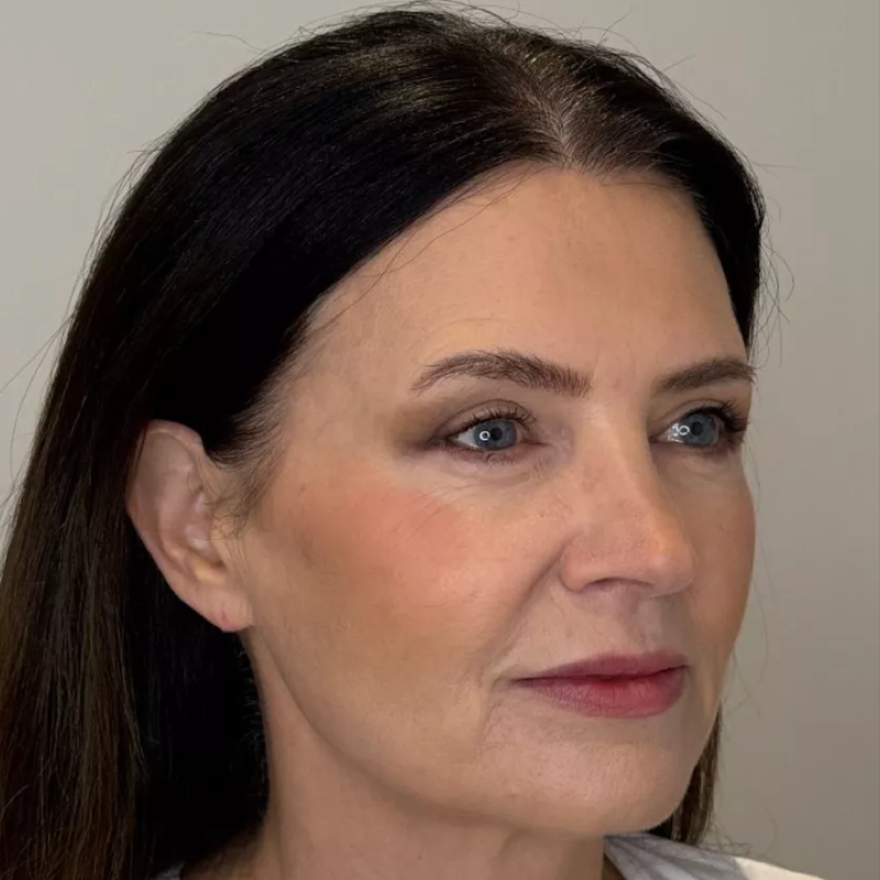 Younger skin