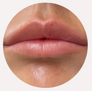 1. Apply it to your lips