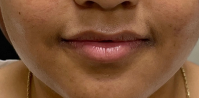 <p><strong>Noémi A.</strong></p>