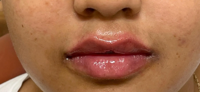 <p><strong>Noémi A.</strong></p>