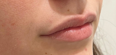 <p><strong>Ainhoa Z.</strong></p>