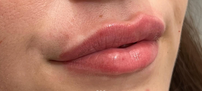 <p><strong>Ainhoa Z.</strong></p>