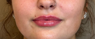 <p><strong>Laia K.</strong></p>