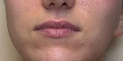 <p><strong>Lurdes A.</strong></p>