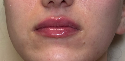 <p><strong>Lurdes A.</strong></p>