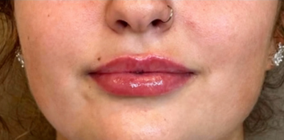 <p><strong>Noémi A.</strong></p>