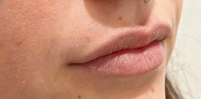 <p><strong>Sofía R.</strong></p>