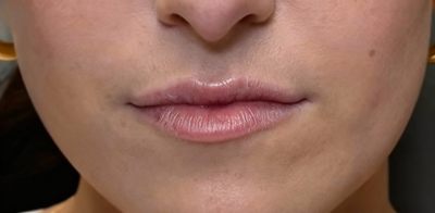 <p><strong>Claudia F.</strong></p>