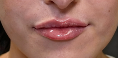 <p><strong>Claudia F.</strong></p>