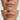Lip-Plumper